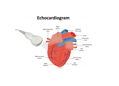 ECHO