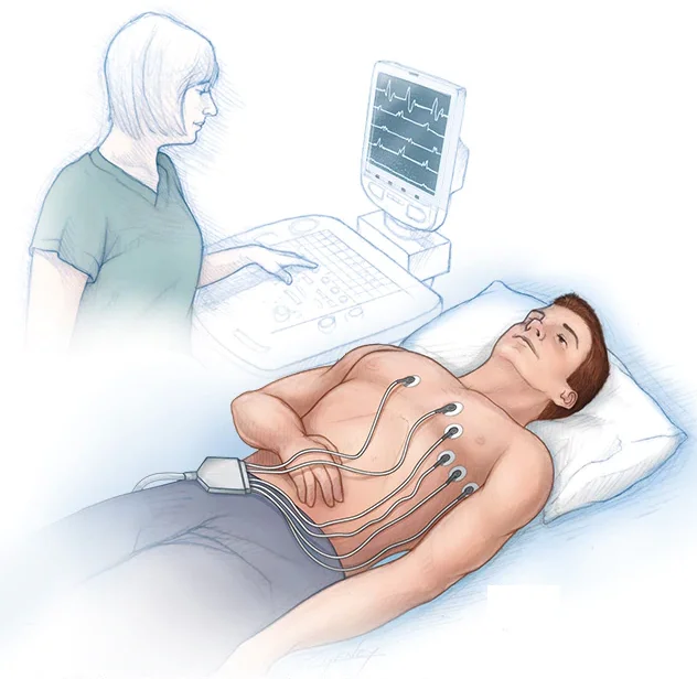 ECG Test